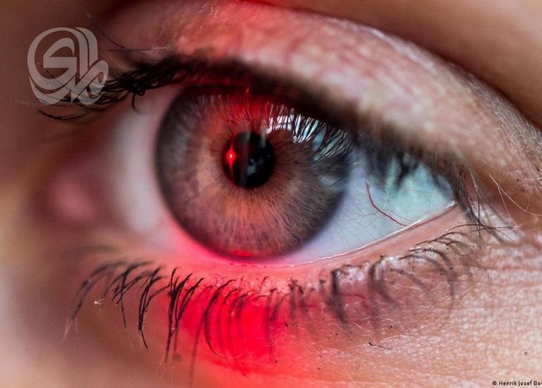 عوامل لحماية العيون من ارتفاع درجات الحرارة.. تعرف عليها