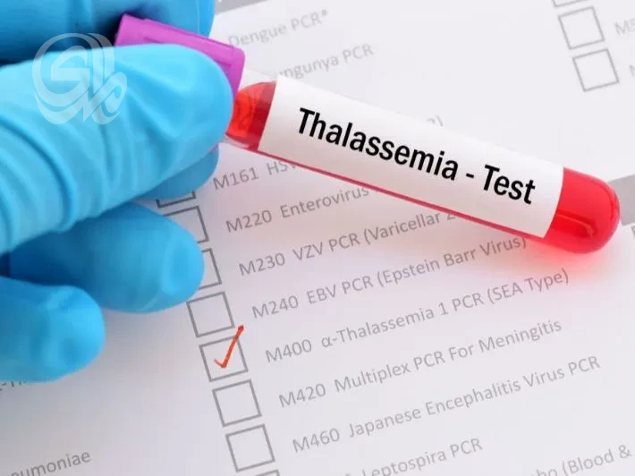 الصحة تتخذ إجراءات للحد من الإصابة بـ